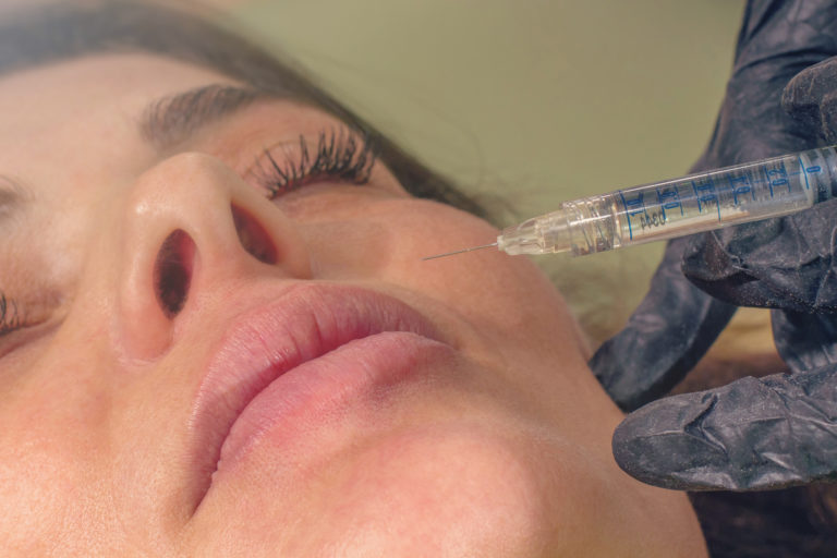 Can Injectable Fillers Achieve Long-lasting Results